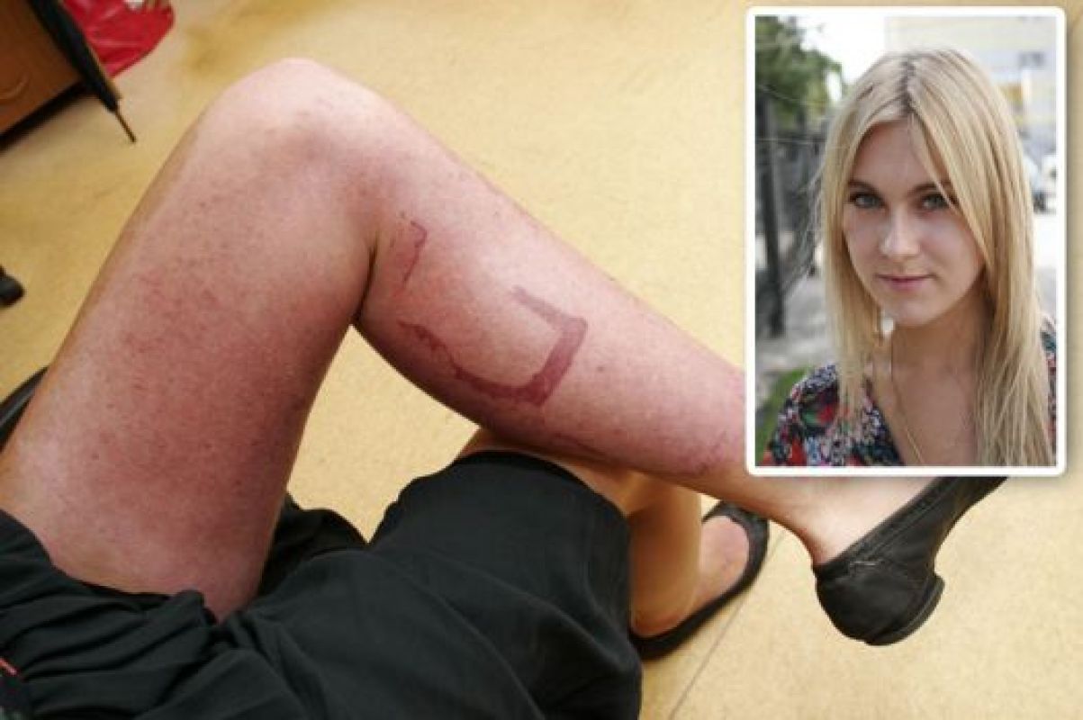 После происшествия на занятиях по вождению Таня носит длинные юбки, чтобы никто не видел её ног